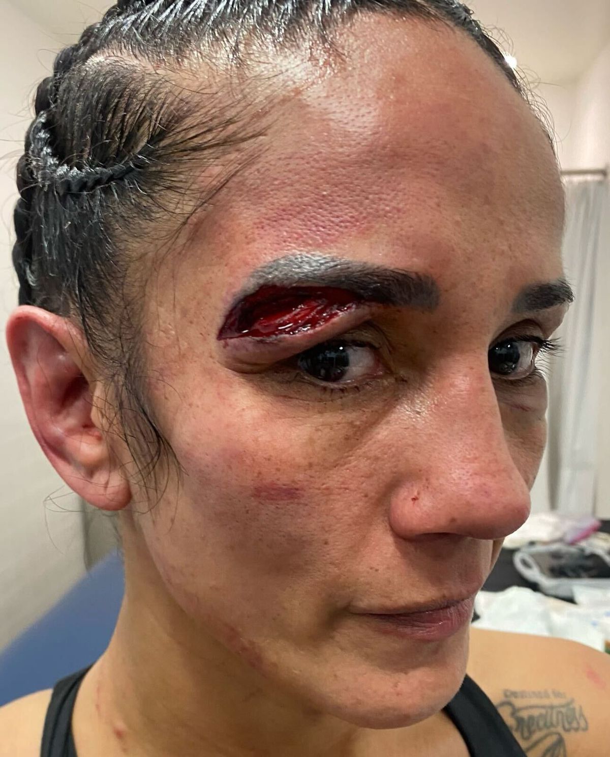 Amanda Serrano muestra un corte espantoso sufrido por numerosos cabezazos en la revancha con Katie Taylor