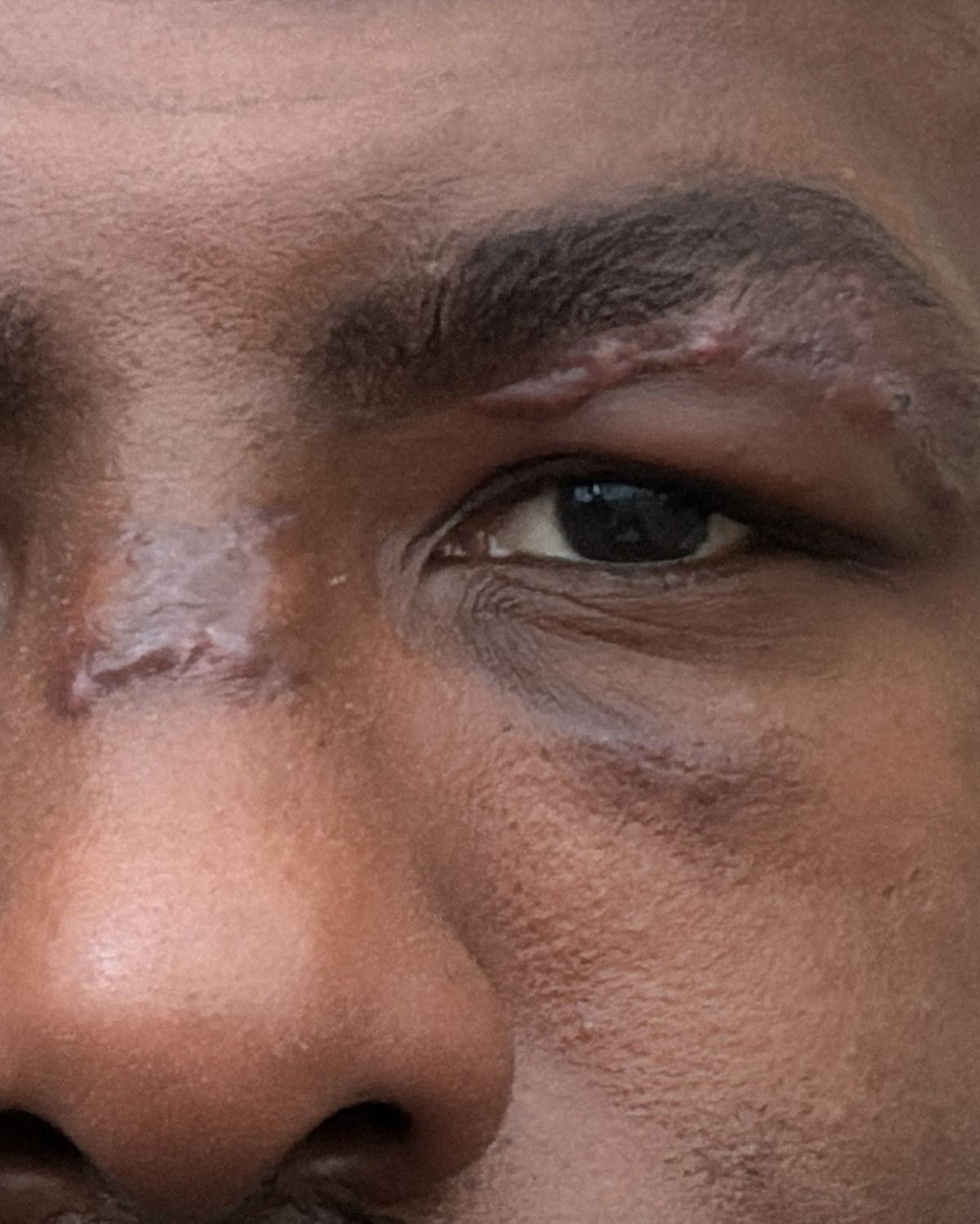 Khalil Rountree Jr. comparte foto actualizada de las lesiones faciales de la batalla de UFC 307 con Alex Pereira