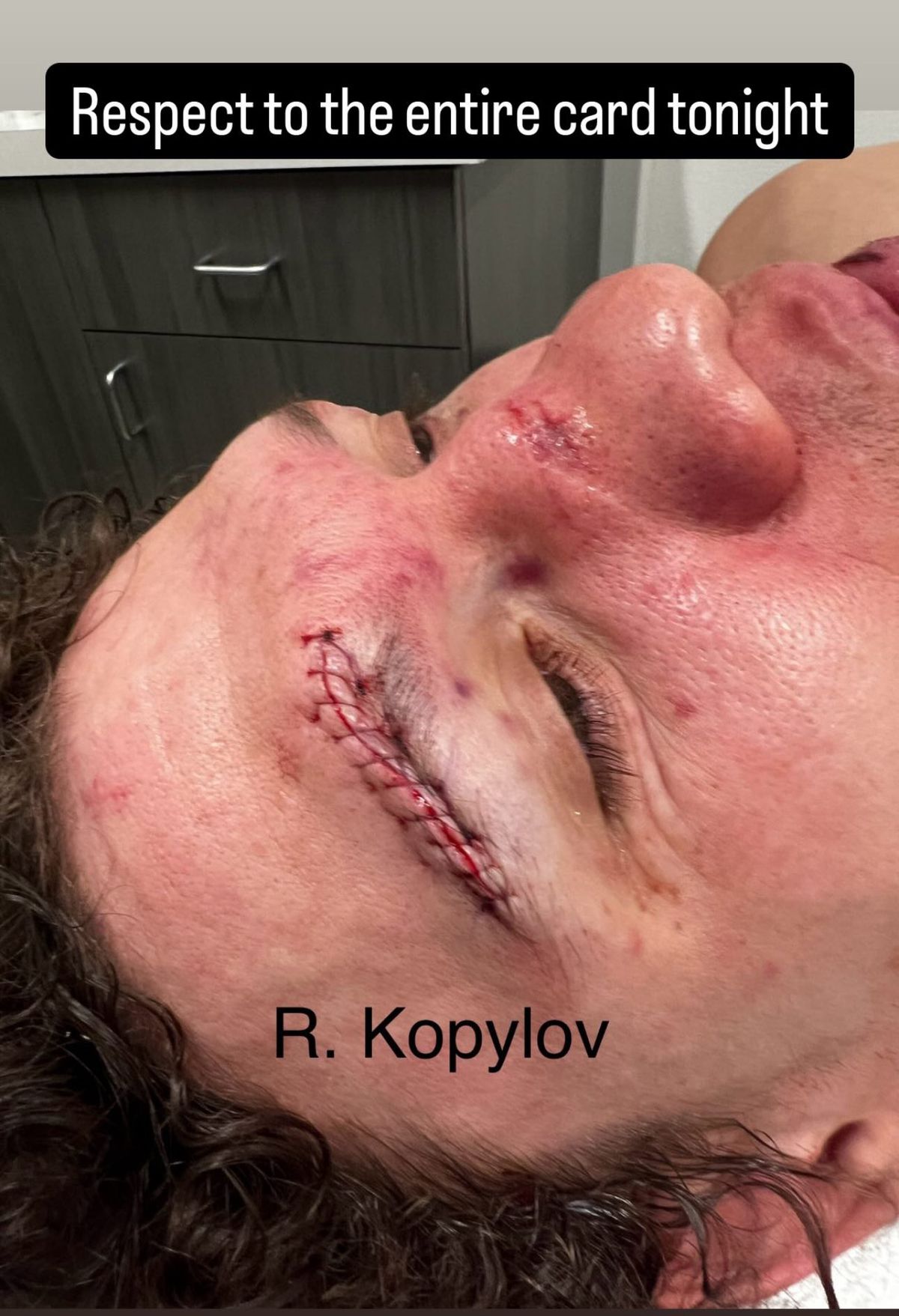 Foto: Roman Kopylov sufrió un corte espantoso durante la victoria por nocaut sobre Chris Curtis en UFC Vegas 101