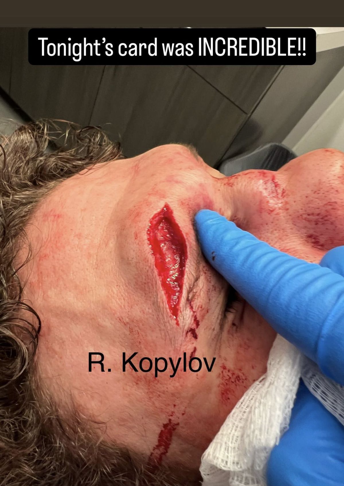 Foto: Roman Kopylov sufrió un corte espantoso durante la victoria por nocaut sobre Chris Curtis en UFC Vegas 101